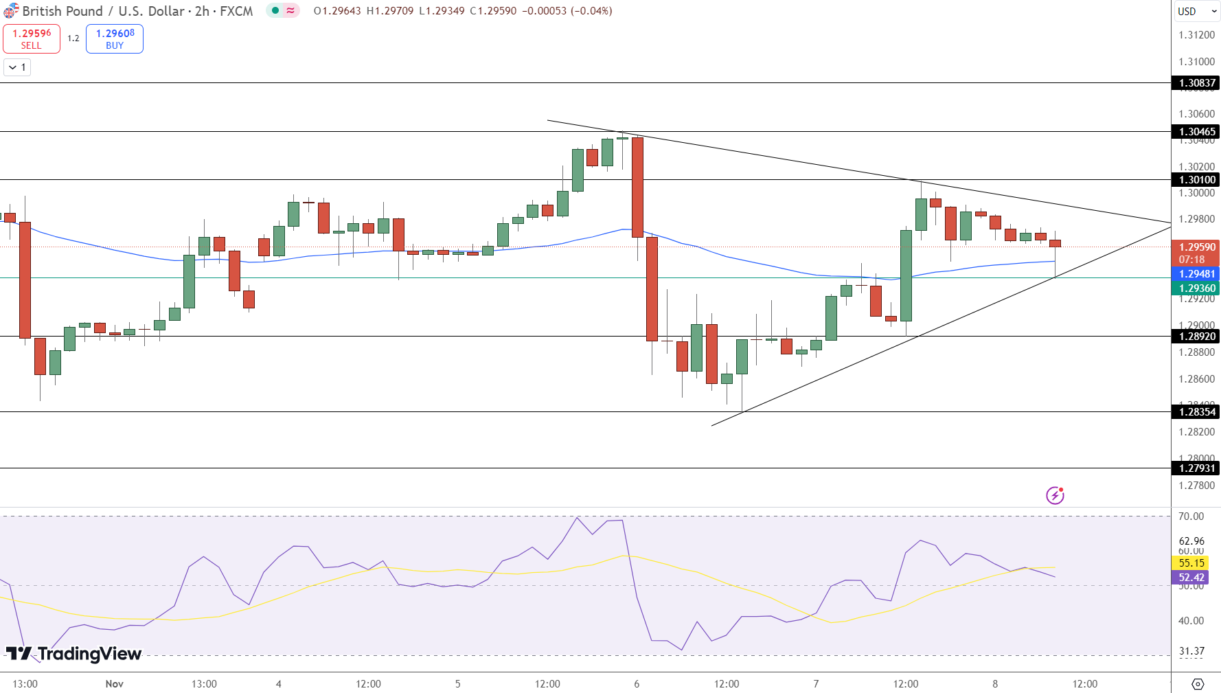 GBP/USD Price Chart - Source: Tradingview